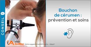 Causes des oreilles bouchées se déboucher les oreilles naturellement l'huile d'olive pour se déboucher les oreilles alcool et vinaigre de cidre la causes des oreilles bouchées. Retirer Un Bouchon De Cerumen Ideal Audition Ideal Audition