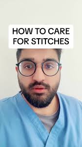 Doctor explains how to look after stitches
