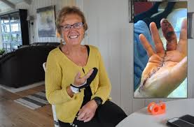 Den er forskerens iskalde blikk og mystikerens gudsvisjon. Helse Sykdom Solveig 69 Ble Angrepet Av Kjottetende Bakterier