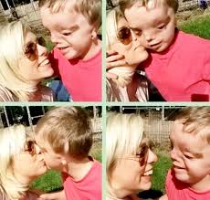 Disabled boy's picture pulled from Instagram after being reported over  facial deformity