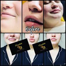 Ocean Bay Aesthetics,LLC