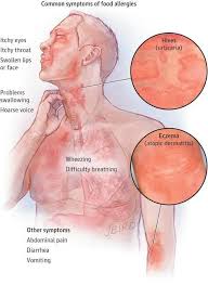 Whether you're trying to lower your cholesterol or you're trying to prevent it from rising, there are certain foods that you can eat that will help move the process along. Allergy Symptoms Max Cellgevity Solutions Facebook