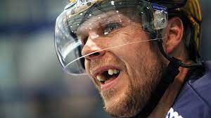 Der helm mit gitter garantiert die sicherheit und befreit sie vor der gefahr, dass sie mit der scheibe getroffen werden, oder dass sie ihre zähne verlieren. So Behandelt Man Zahnverletzungen Netzathleten De