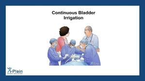 Image result for Continuous Bladder Irrigation