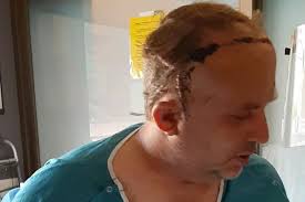 Fundraiser by Terry Hamel : Brain Stroke Recovery