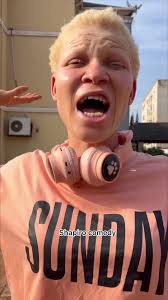 Funny Girlfriend Prank with Albino Girlfriend