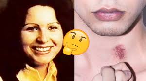 13 True Medical Stories That Will Make You Gasp, "OH MY GOD!"