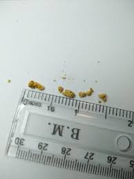 Colicile reprezinta una dintre cauzele pentru care multi pacienti ajung in regim de urgenta la spital din cauza. Renoregim Tratament Naturist Pietre La Rinichi 4 Flacoane Cura Pentru 2 Luni In Limita Stocului