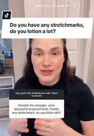 Secrets to Managing Stretch Marks During Pregnancy