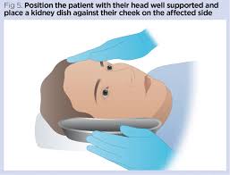 Image result for Eye Irrigation