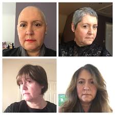 Check spelling or type a new query. Of Hair Regrowth After Chemo Macmillan Online Community
