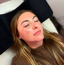 Microblading top up❣️