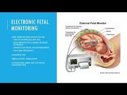 Image result for Fetal Testing Indications