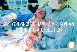 Why You Should Have A Birth Plan Even With A C Section Birth Plan Birth Plan Template C Section