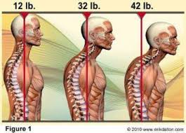 Published By Dana Ben Yehuda Of Alexander Technique Studio Forward Head Posture Foam Roller Exercises Massage Therapy