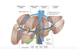 The liver tissue of an alcoholic may become clogged with fats and adversely affect liver function. International Liver Transplantation Society Couinaud S Segmental Anatomy Of The Liver And Proposed Classification Of Pediatric Liver Tumors