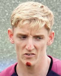 England Euro 2024 star Anthony Gordon 'got brakes mixed up' before  high-speed bike crash as he shows off his injuries