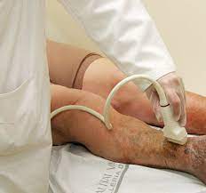 Maybe you would like to learn more about one of these? Chguv Angiologia Y Cirugia Vascular