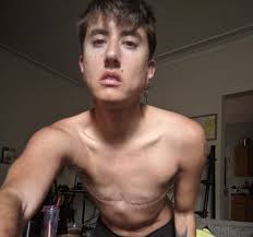 My Transgender Year Without Tits