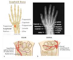 Image result for Scaphoid Fracture Signs