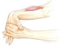 What Is Bursitis Symptoms And Treatment What Is Bursitis It S The Inflammation Of The Bursa That Commonly Aff Bursitis Symptoms Bursitis Bursitis Treatment
