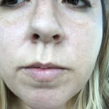 THE SPA AT SOUTH BAY PLASTIC SURGEONS