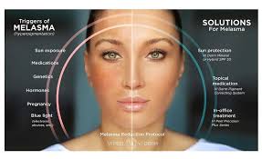 Image result for Melasma