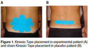 Middle back pain the middle back is a combination of vertebrae from the upper and middle sections of the back and muscles that. Taping For Low Back Pain Pogo Physio Gold Coast