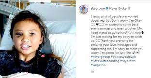 Sky Brown 11 Year Old Skateboarder Is Recovering In Hospital After Worst Fall Yet Cbbc Newsround
