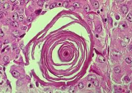 Medical licensing examination® (usmle®) is a joint program of the fsmb and nbme. Wbr0863 Wikidoc