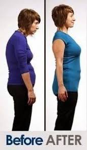Posture Correction Exercises Stretch Tips Posture Exercises Improve Posture Bad Posture