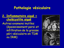 This makes the uterine walls grow thicker. Imagerie Des Voies Biliaires Ppt Video Online Download