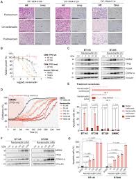 A window-of-opportunity trial reveals mechanisms of response and resistance  to navtemadlin in patients with recurrent glioblastoma | Science  Translational Medicine