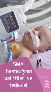 Sma Hastaligi Nedir Sma Hastaligi Olumcul Mu Sma Hastaligi Belirtileri Ve Tedavisi 2020 Cocuk Saglik Bebek