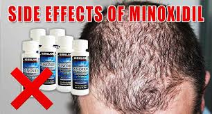 Using hair colors can cause allergic reactions in some people. The Good The Bad And The Side Effects Of Minoxidil Lewigs