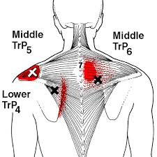 It is one of the main muscles of our upper part of the back. Referred Pain Patterns Red From The Upper And Middle Trapezius Muscle Download Scientific Diagram