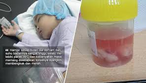 Akan tetapi, jika suhu tubuh anak melebihi. Hampir Setiap Bulan Dia Demam Dengan Suhu Tinggi Disebabkan Tonsilnya Ibu Beri Peringatan Jangan Ambil Mudah Dengan Masalah Tonsil Pada Anak The Reporter