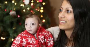 Heart surgery a success for Baby Adrian