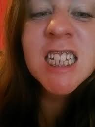 I have shortness of breath, body aches, but the worst is when my face  hurts. Especially my jaws.