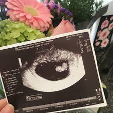 We did not find results for: My Twelve Week Miscarriage Story The Functional Bump