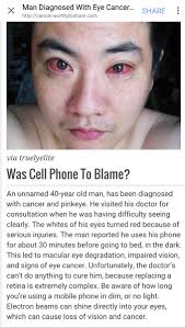 Little did mark hood know how life would change the day his reading glasses broke. Nitasha Natu On Twitter Man Gets Eye Cancer From Using Mobilephone In The Dark Every Night Before Sleeping Dont Know How True But Scary Https T Co C7ew2cb82a