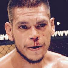 Arthur Belarde vs. Gilbert Perez, Breakthrough MMA 18