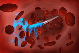 What causes insulin resistance and prediabetes? Researchers Develop A New Ultrafast Insulin For Management Of Blood Sugar In Diabetes
