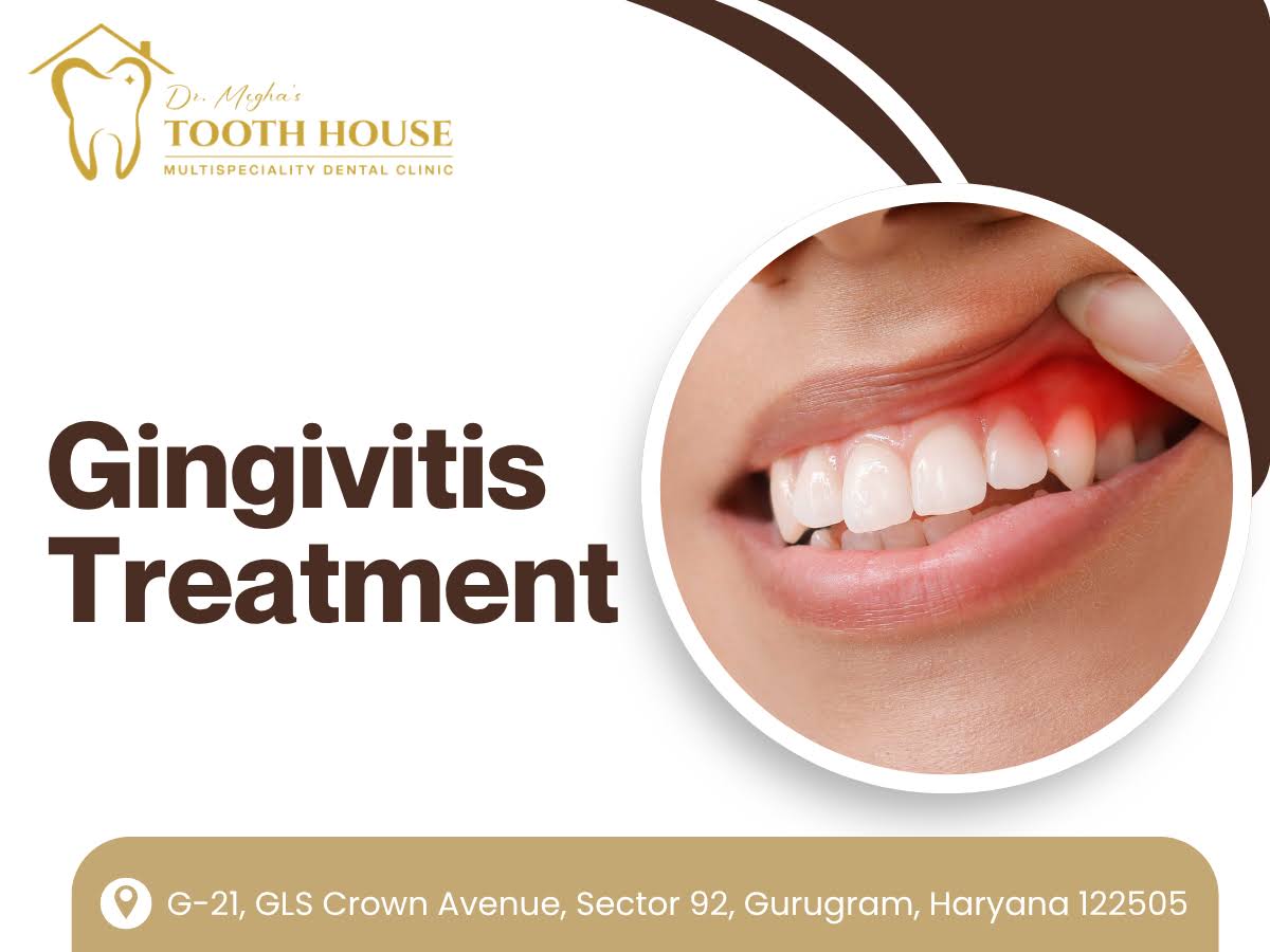 Gingivitis Treatment product image