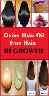 Funny enough, sometimes the solutions are just in the simple things we do or use. Are You Worried About A Receding Hairline Or Bald Patches Do You Feel Your Hair Is Becoming Thinner Fast Hair Regrowth Thick Hair Remedies Hair Loss Remedies