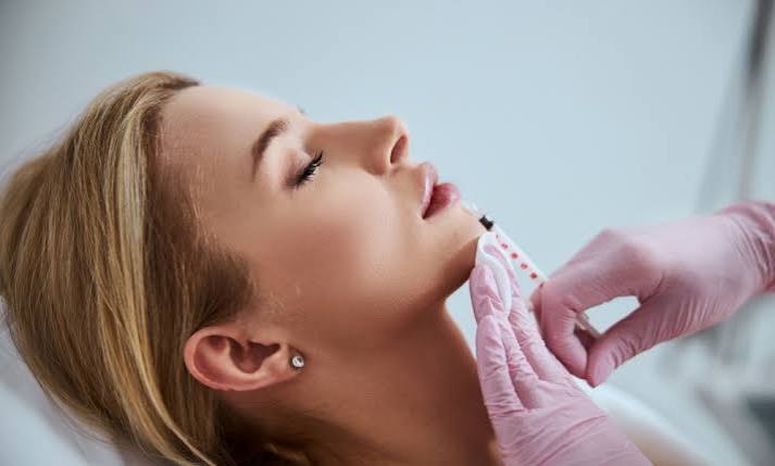 Dermal Fillers - DermEffects | Cosmetic and Medical Dermatology Clinic In  London