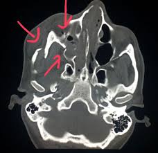 Pin En Ct Scans