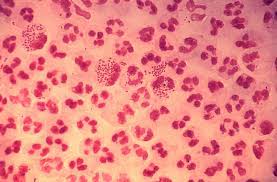 Urine drug tests for weed, then, are essentially trying to detect evidence that your body is still working on eliminating the waste products from your last encounter with thc. File Gonococcal Urethritis Phil 4085 Lores Jpg Wikimedia Commons