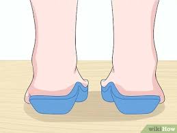 Learn how to safely protect your knees while hiking downhill or uphill. 3 Ways To Fix Knock Knees Wikihow