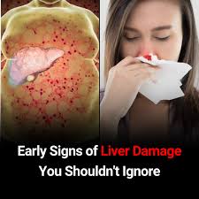Early Signs of Liver Damage & How to Strengthen Your Liver 👇👇